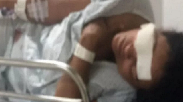 Noemi teve um pedaço do rosto arrancado por uma mordida (Foto: Reprodução)