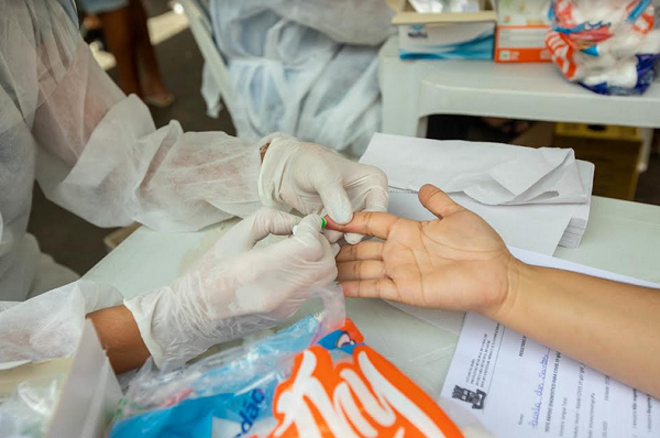 A Sesau reafirma que o teste está disponível, mas somente após passar pela avaliação médica e agendamento do mesmo (Foto: Jean Victor)