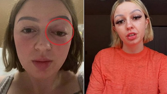 Bethany Collins, de 23 anos (Foto: Reprodução)