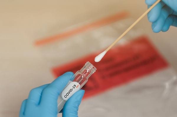 A nova cepa não tem gravidade aparente e que combina as subvariantes BA.1 e BA.2 (Foto: Reprodução)