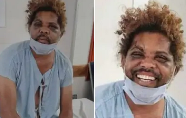 Morador em situação de rua foi levado ao hospital após ser espancado no DF (Foto: Redes Sociais/Reprodução)
