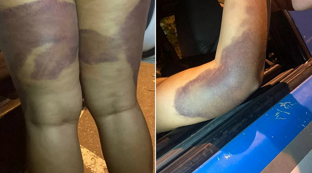 No local, a jovem foi encontrada com várias lesões pelo corpo (Foto: Reprodução)