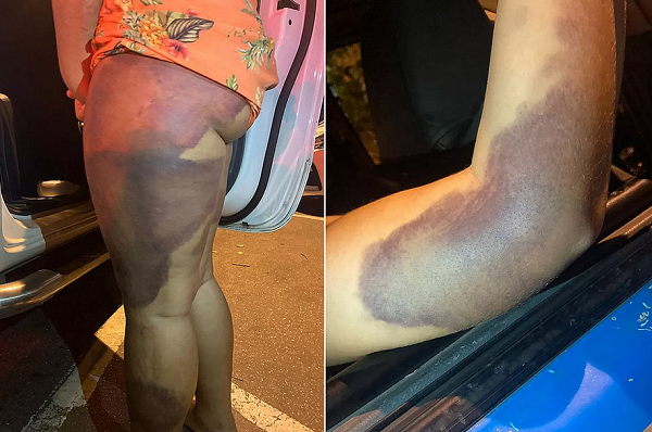 Jovem de 22 anos foi resgatada por policiais militares após ter sido mantida em cárcere privada por seis dias e estuprada pelo casal de sogros (Foto: Reprodução)