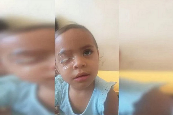 Criança terá de passar por uma cirurgia para recuperar a visão do olho direito (Foto: Reprodução/Metropoles)