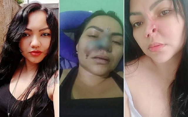 Elielma Carvalho Braga, 37 anos (Foto: Reprodução)