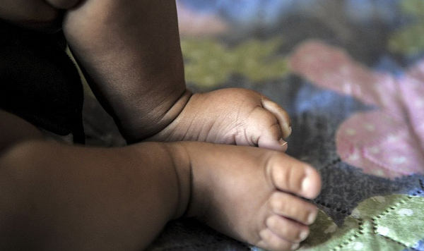 O bebê tem dois meses e começou a apresentar os primeiros sintomas da doença no último dia 5 de agosto (Foto: Marcello Casal Jr/Agência Brasil/Arquivo)