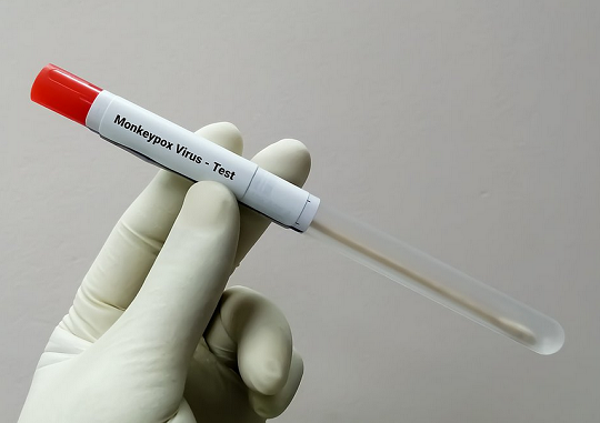 Brasil receberá o antiviral Tecovirimat para 'reforçar o enfrentamento ao surto' de varíola dos macacos (Foto: Shutterstock)