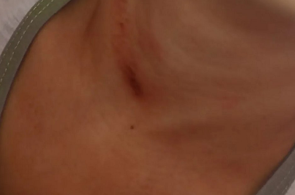 Mãe afirmou que, desde então, o menino mudou de comportamento, está assustado, com medo de sair de casa e tendo pesadelos constante (Foto: Reprodução)