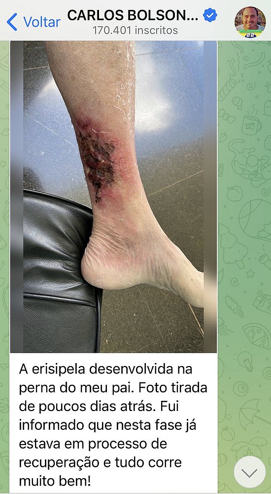 (Foto: Reprodução)