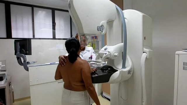 Interessadas em fazer o exame devem marcar por e-mail (Foto: Ascom Sesab)