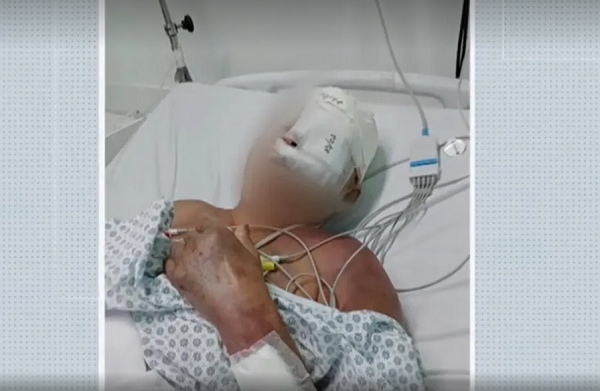 Idosa tem todos os dentes quebrados após ser agredida a pauladas na Bahia (Foto: Reprodução/TV Bahia)