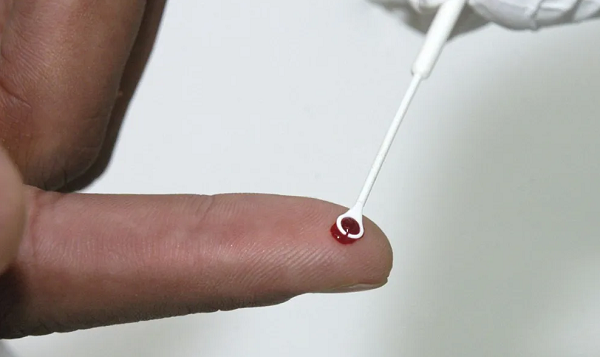 O medicamento injetável passa a representar uma nova opção na profilaxia pré-exposição (PrEP) no Brasil (Foto: Vinicus Marinho/Fiocruz)