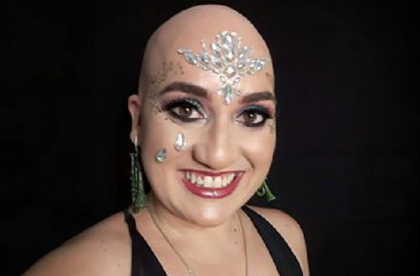 Lolla Angelucci: queda se tornou acentuada aos 18 anos (Foto:  Arquivo pessoal)