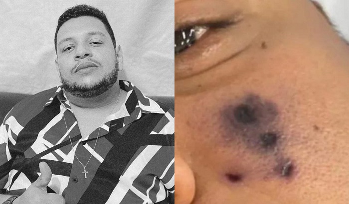 O artista passou a se sentir mal e seu rosto começou a escurecer antes de ser internado - Foto: Reprodução