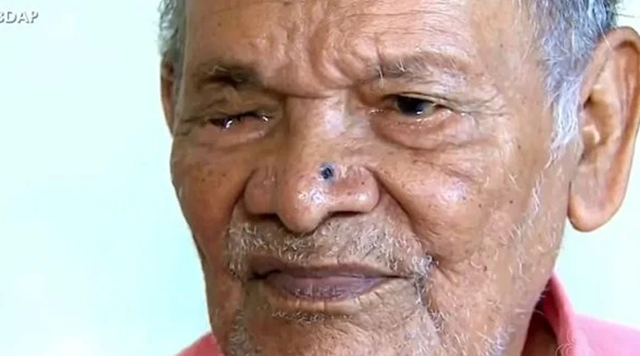Mais de cem pessoas tiveram alguma complicação (Foto: Reprodução/Rede Amazônica)
