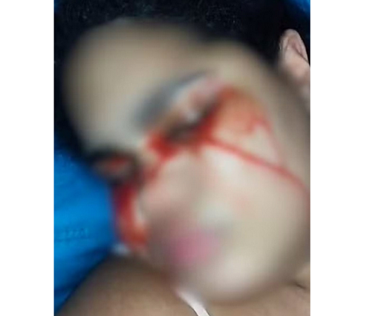 Jovem começou a sangrar pelos olhos em abril de 2024 (Foto: Reprodução)