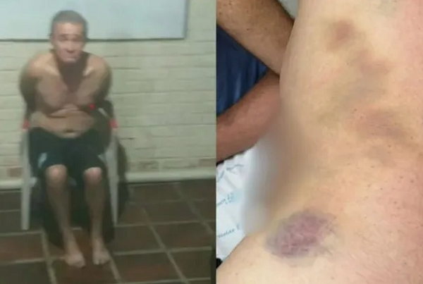 A vítima, identificada como Jarmo Celestino De Santana, chegou a ser socorrido, mas não resistiu aos ferimentos (Foto: Arquivo pessoal)