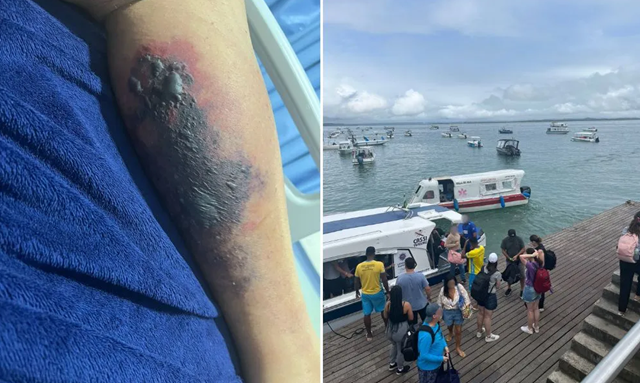 Homem foi picado em um restaurante da região, na última terça (Foto: Reprodução/Redes Sociais)