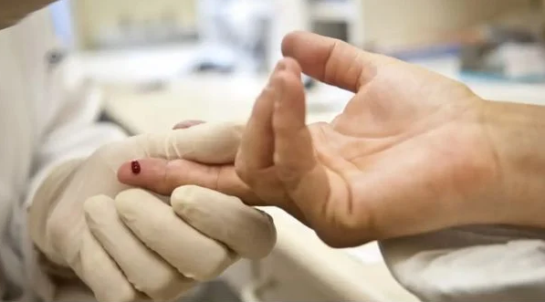 Exame para HIV (Foto: Arquivo Agência Brasil)