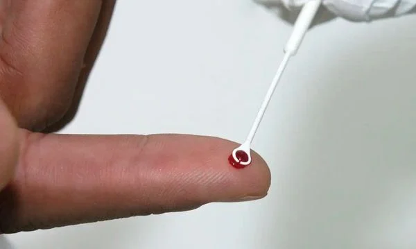 Teste de HIV (Foto: Vinicus Marinho/Fiocruz)
