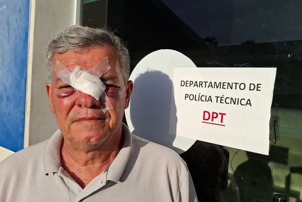 Ex-vereador de Camaçari, Zé do Pão (Foto: Divulgação)