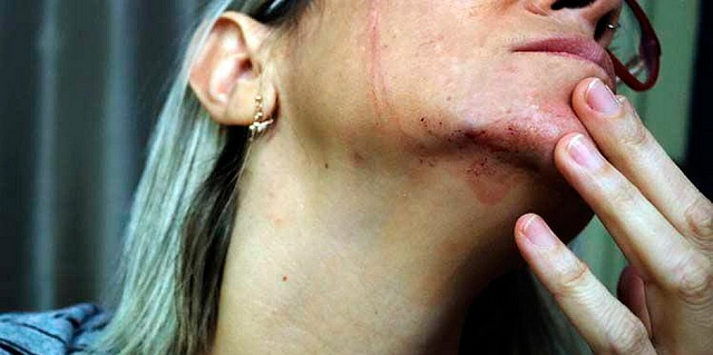De acordo com a vítima, de 40 anos, dois homens a agrediram e a ameaçaram de estupro no momento em que saía do local de votação (Foto: Sérgio Bernardo | JC Imagem) De acordo com a vítima, de 40 anos, dois homens a agrediram e a ameaçaram de estupro no momento em que saía do local de votação (Foto: Sérgio Bernardo | JC Imagem)