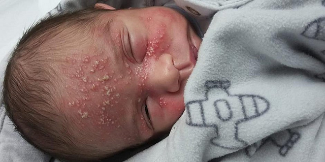 Rafaela resolveu publicar em suas redes sociais para alertar os pais sobre os riscos desse tipo de contato com recém-nascidos (Foto: Reprodução)