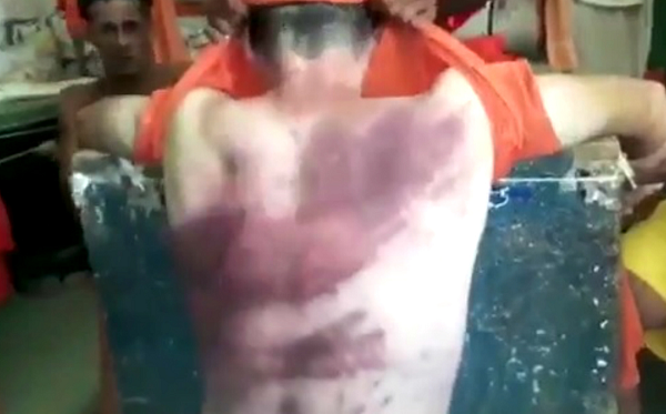 Alexsandro apanhou com socos e um objeto semelhante a um pedaço de pau, que estava enrolado em um pano (Foto: Reprodução) Alexsandro apanhou com socos e um objeto semelhante a um pedaço de pau, que estava enrolado em um pano (Foto: Reprodução)