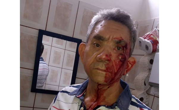 O professor Paulo Rafael Procópio, de 62 anos, ensanguentado no banheiro da escola após a agressão: 'Decepção' (Foto: Arquivo pessoal) O professor Paulo Rafael Procópio, de 62 anos, ensanguentado no banheiro da escola após a agressão: 'Decepção' (Foto: Arquivo pessoal)