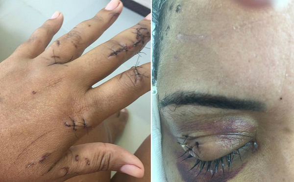 A fisioterapeuta Isabela Oliveira Conde, 36 anos, tinha tudo para entrar nesses números, mas, apesar de ter levado 69 facadas entre o tórax e cabeça, no último dia 28 de fevereiro, sobreviveu para relatar sua luta pela vida (Foto: Reprodução) A fisioterapeuta Isabela Oliveira Conde, 36 anos, tinha tudo para entrar nesses números, mas, apesar de ter levado 69 facadas entre o tórax e cabeça, no último dia 28 de fevereiro, sobreviveu para relatar sua luta pela vida (Foto: Reprodução)