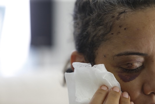 Sem enxergar do olho direito, Isabela tem prognóstico de melhora com nova cirurgia (Foto: Marina Silva) Sem enxergar do olho direito, Isabela tem prognóstico de melhora com nova cirurgia (Foto: Marina Silva)