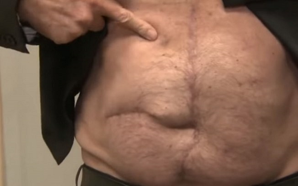 O presidente mostrou a barriga durante uma entrevista ao SBT Brasil, que foi exibida na noite dessa quinta-feira (2) (Foto: Reprodução) O presidente mostrou a barriga durante uma entrevista ao SBT Brasil, que foi exibida na noite dessa quinta-feira (2) (Foto: Reprodução)