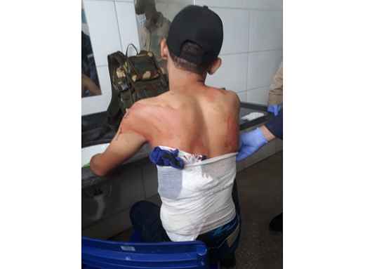 Aluno de 18 anos foi esfaqueado nas costas (Foto: PM-MT | Divulgação)