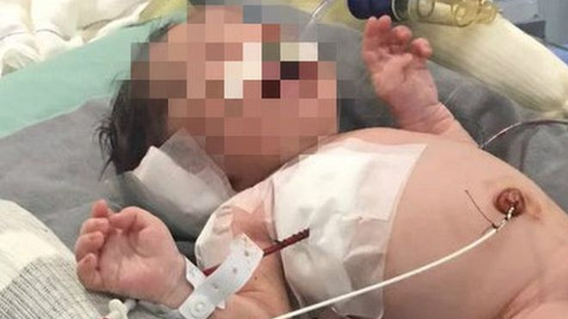 Bebê que foi baleado na cabeça no útero da mãe (Foto: Ilustrativa) Bebê que foi baleado na cabeça no útero da mãe (Foto: Ilustrativa)