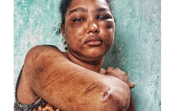 Deisiane foi torturada e mantida durante seis meses em cárcere privado (Foto: Evandro Veiga | CORREIO) Deisiane foi torturada e mantida durante seis meses em cárcere privado (Foto: Evandro Veiga | CORREIO)