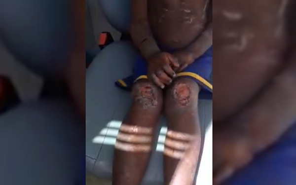Menina foi encontrada com vários ferimentos pelo corpo, assim como os irmãos, segundo a polícia (Foto: TV Anhanguera | reprodução)