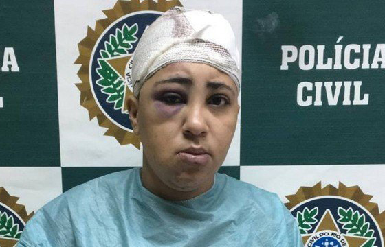 Beatriz Santana Honório, de 27 anos (Foto: Divulgação)
