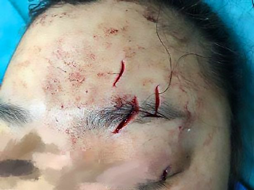 A professora de mergulho teve de passar por 4 horas de cirurgia após ataque (Foto: AsiaWire) A professora de mergulho teve de passar por 4 horas de cirurgia após ataque (Foto: AsiaWire)