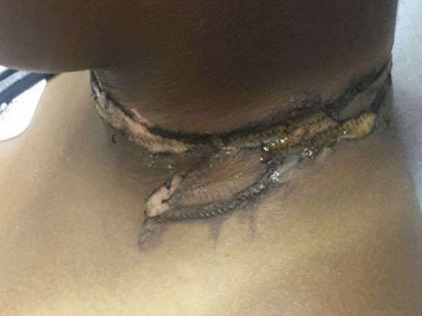 (Foto: Anais de Medicina de Emergência | Divulgação)